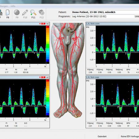 handydop-pro Software vasoview