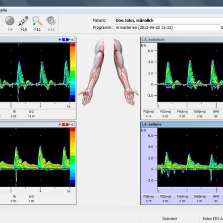 handydop-pro Software vasoview